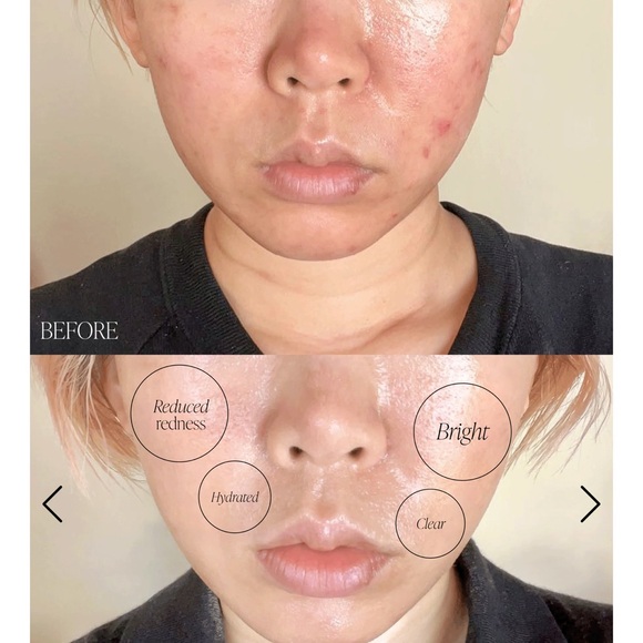 NWT Byroe Basil Dark Spot Correcting Cream - 1.01 fl oz - Picture 4 of 8